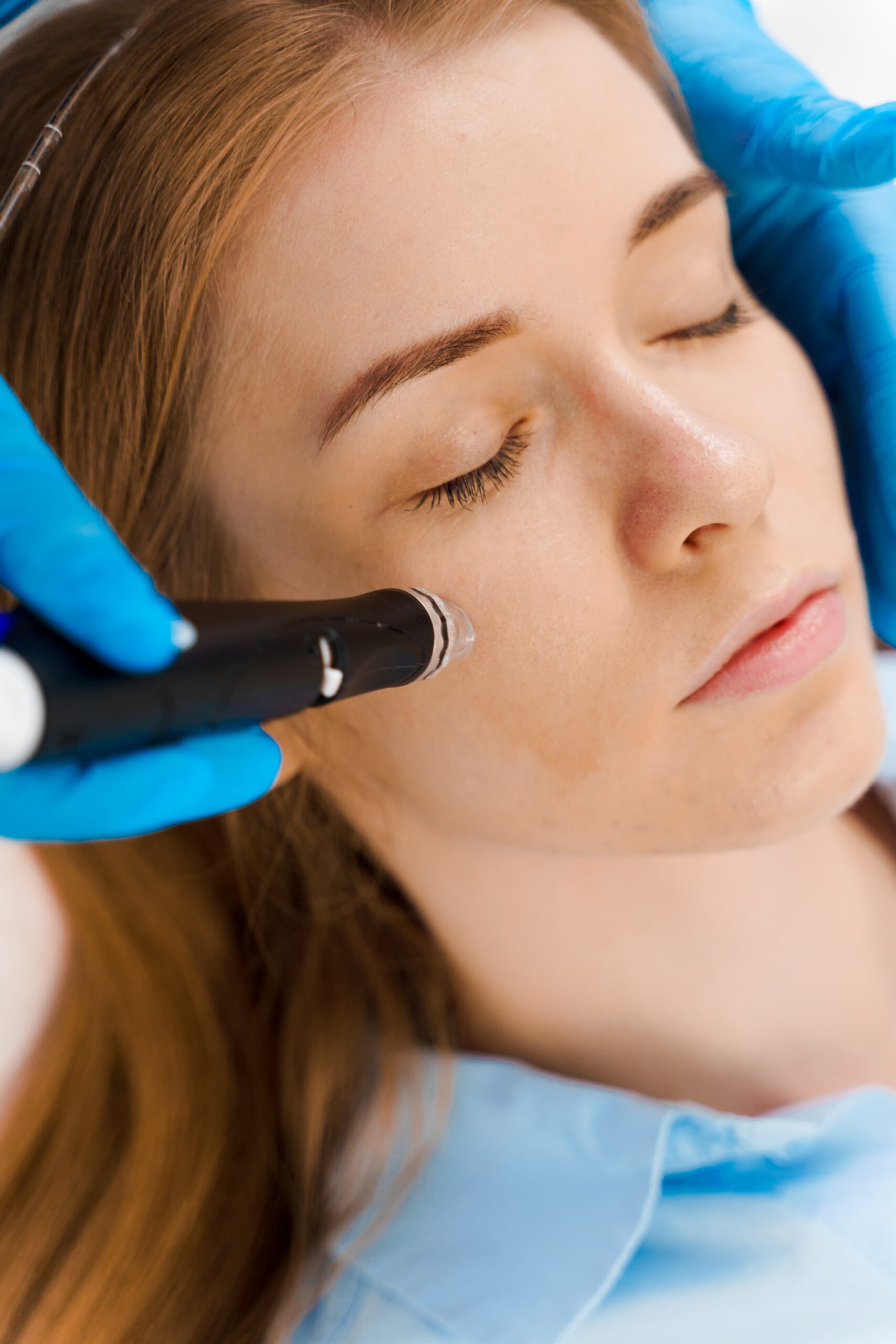 hydrafacial purifying procedure with medical device beauty center beautician doing facial cleansing skincare women painless facial purifying clinic 2 scaled Micro-needling in Louisville